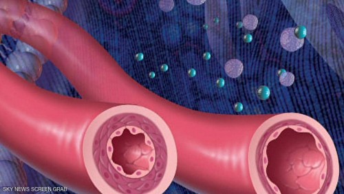 [[article_title_text]]