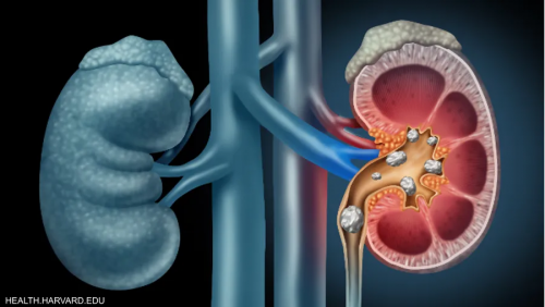 [[article_title_text]]